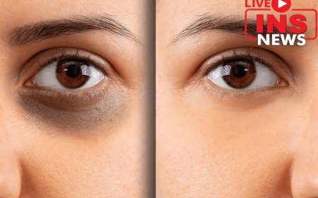 You are worried about dark circles, acne marks, pigmentation, wrinkles, or double chin, then try these remedies.